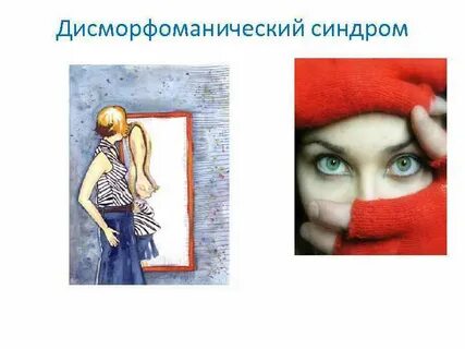 Дисморфомания это