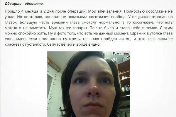 Атипичные формы косоглазия. После операции на косоглазие. Операция по косоглазию до после. Операция по косолапию у взрослых. Операция по косоглазию у взрослых.