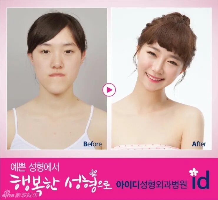 Как отличить корейскую. Корейская внешность. Корейцы внешность. Эволюция корейской внешности. Южная Корея пластическая хирургия.