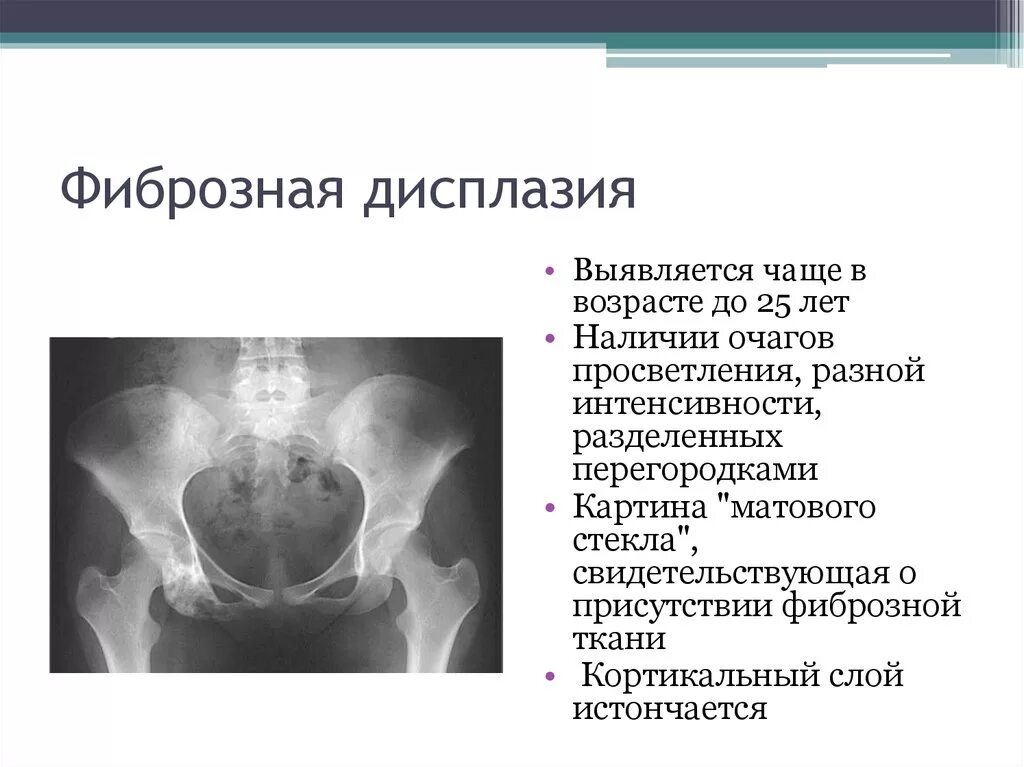 Повторная дисплазия. Тазобедренная дисплазия у собак. Аплазия тазобедренного сустава. Повторная дисплазия. Дисплазия умеренной степени.