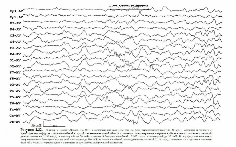 ЭЭГ волны. Бета ритм на ЭЭГ норма у ребенка. Альфа активность на ЭЭГ норма. ЭЭГ принцип метода. Ээг красноярск