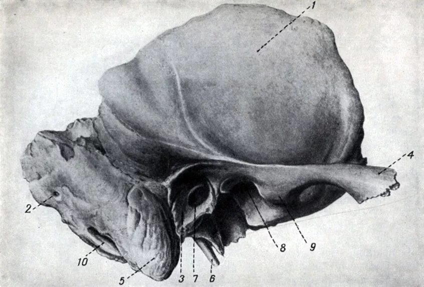 Височная кость атлас Синельникова. Сосцевидный отросток височной кости анатомия. Височная кость скуловой отросток. Кости черепа височная кость. Изменения височной кости