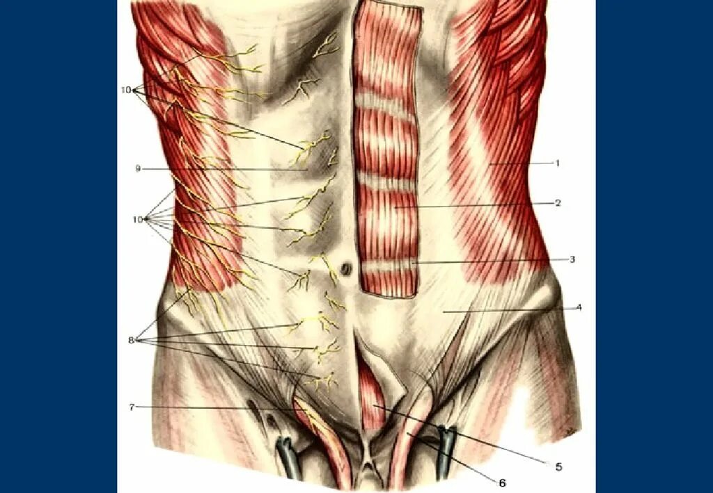 Мышцы передней брюшной стенки топографическая анатомия. Слои передней брюшной стенки топографическая анатомия. Передняя брюшная стенка топографическая анатомия. Переднебоковая брюшная стенка топографическая анатомия. Толстая брюшная стенка
