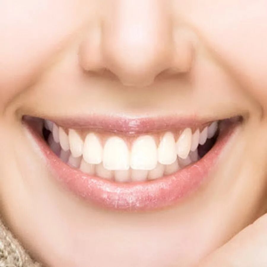 Sparkling smile