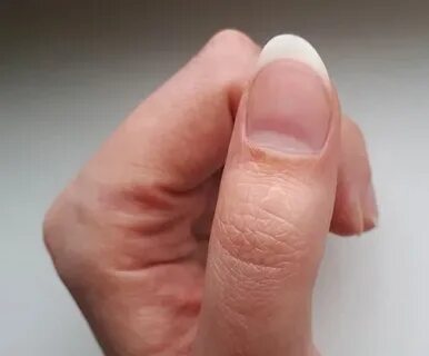 Круглые пальцы на руках