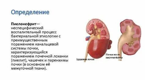 Почечный стол