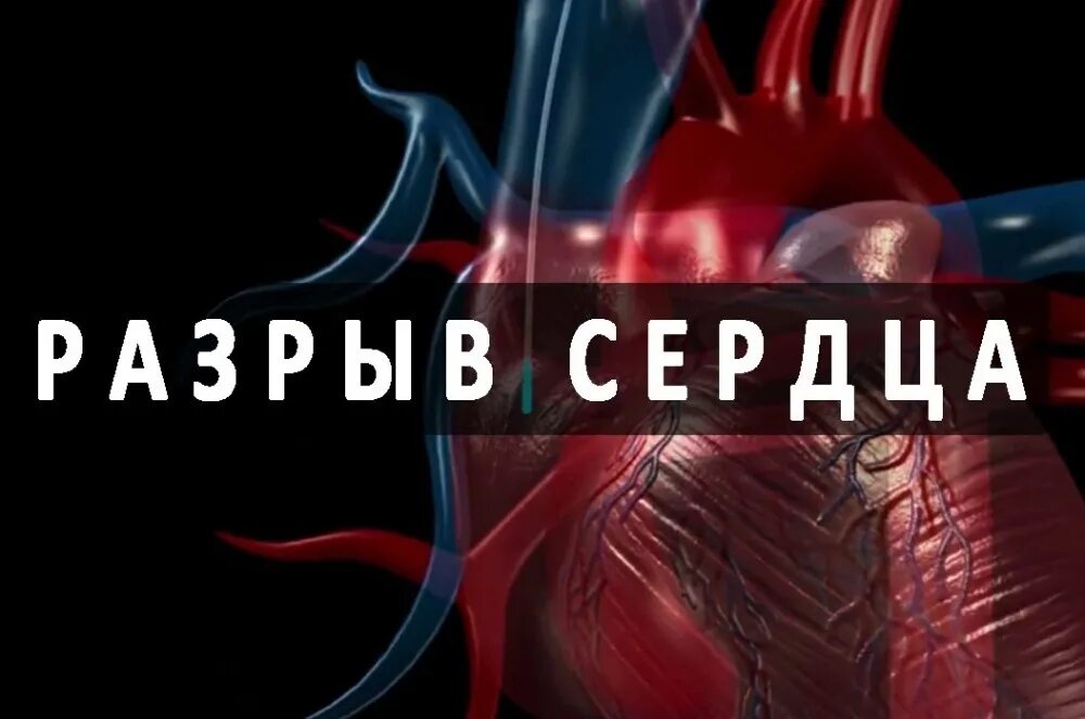 Повреждение миокарда сердца. Наружные разрывы сердца. наружный разрыв миокарда.