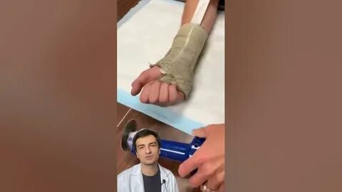 Через месяц снимать гипс