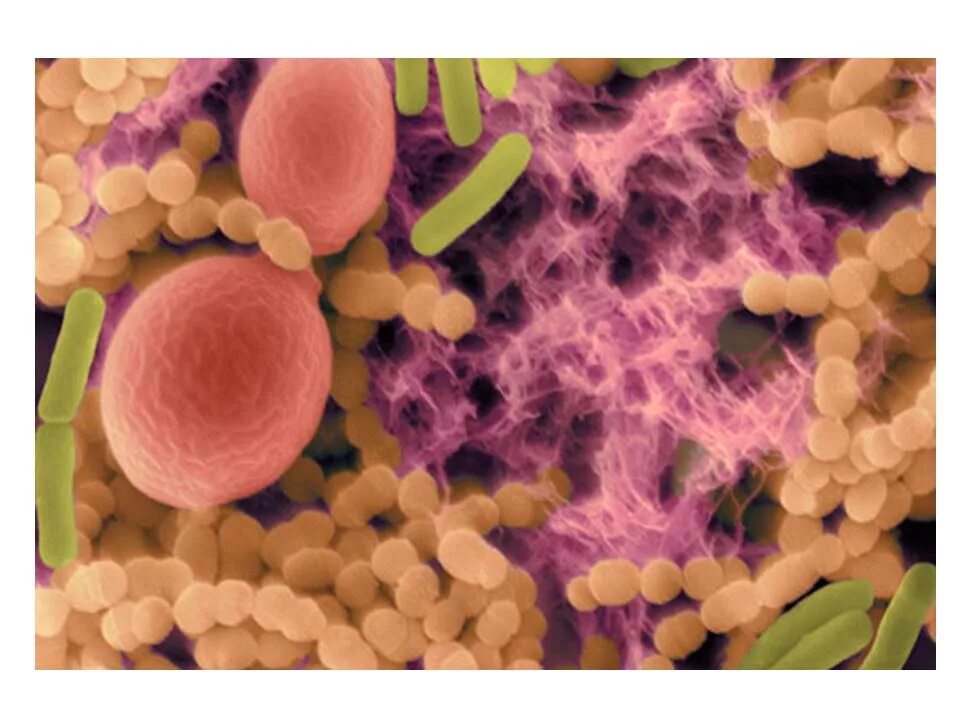 Бактерии неприятный запах. Микроорганизмы ротовой полости. Бактерии ротовой полости человека. Микроорганизмы биопленки в ротовой полости. Патоген микрофлора ротовой полости.