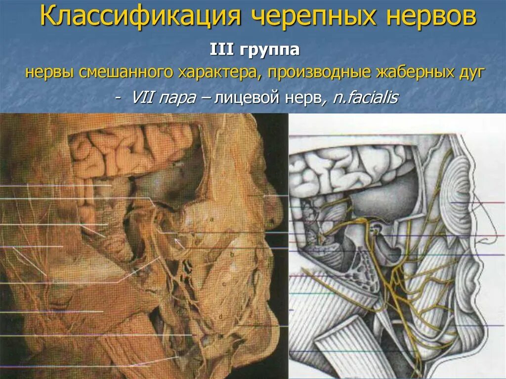 Нервные узлы черепных нервов. Черепные нервы. Лицевые нервы Черепные нервы. Классификация черепных нервов. Смешанные Черепные нервы.