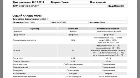 Уробилиноиды в моче