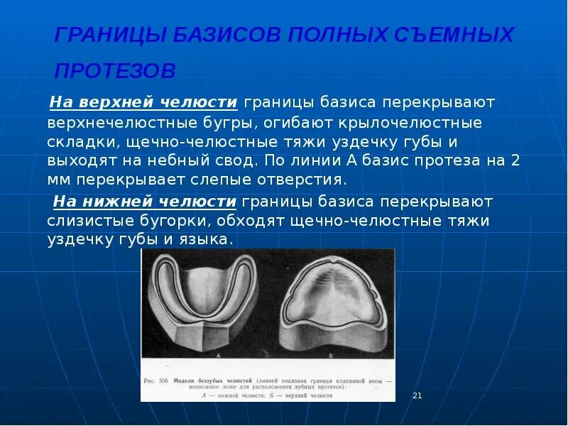 Толщина базиса. Полный съемный протез на верхнюю челюсть граница протезного ложа. Границы протеза на верхней челюсти. Границы протеза на нижнюю челюсть. Границы базиса на верхней челюсти.