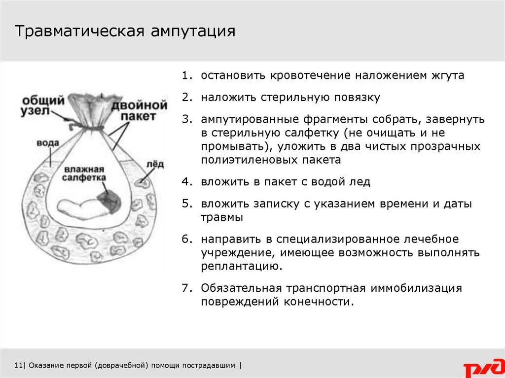 Действия при травматической ампутации. Первая помощь при травматической ампутации конечностей. Неотложная помощь при травматической ампутации конечности. Оказание неотложной помощи при травматической ампутации конечности.. Первая помощь при травматической ампутации кисти.