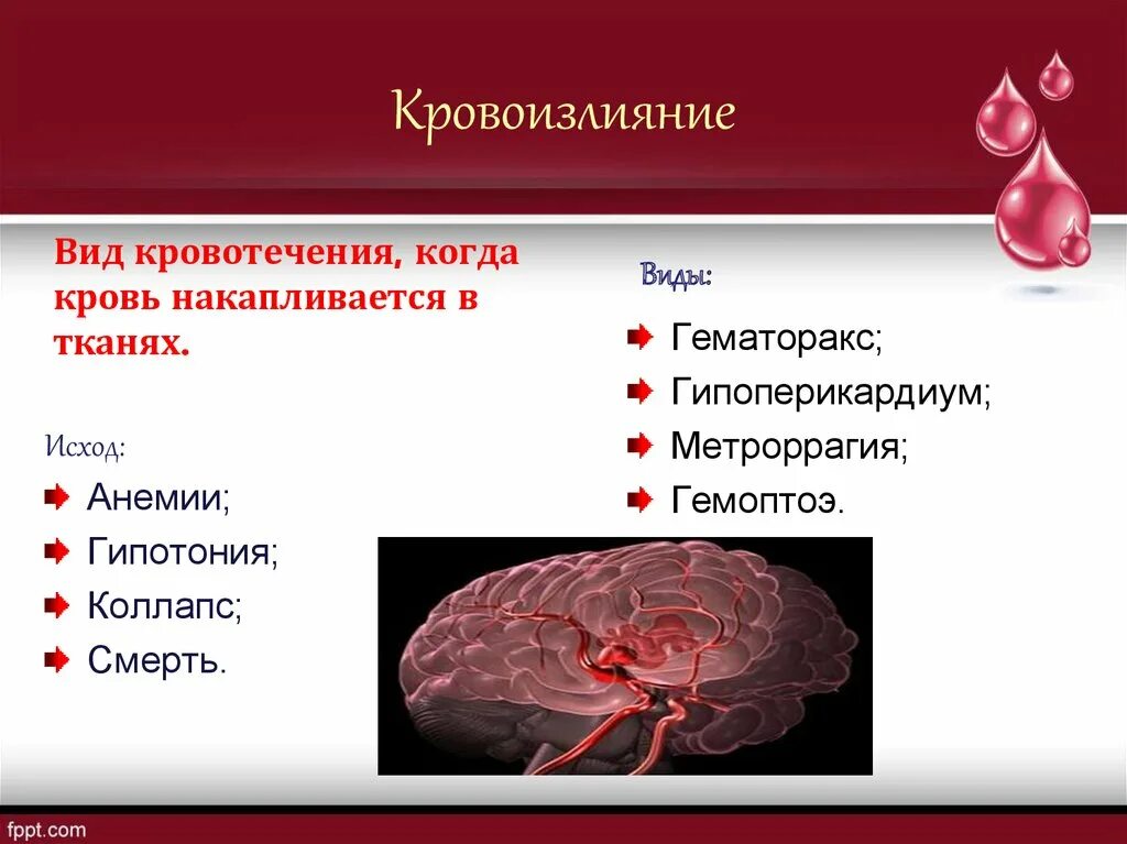 Название кровоизлияния. Кровотечения по виду излияния. Множественная локализация