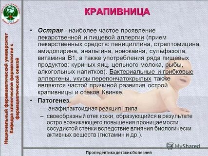 Проблемы при крапивнице