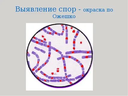 Выявление споров