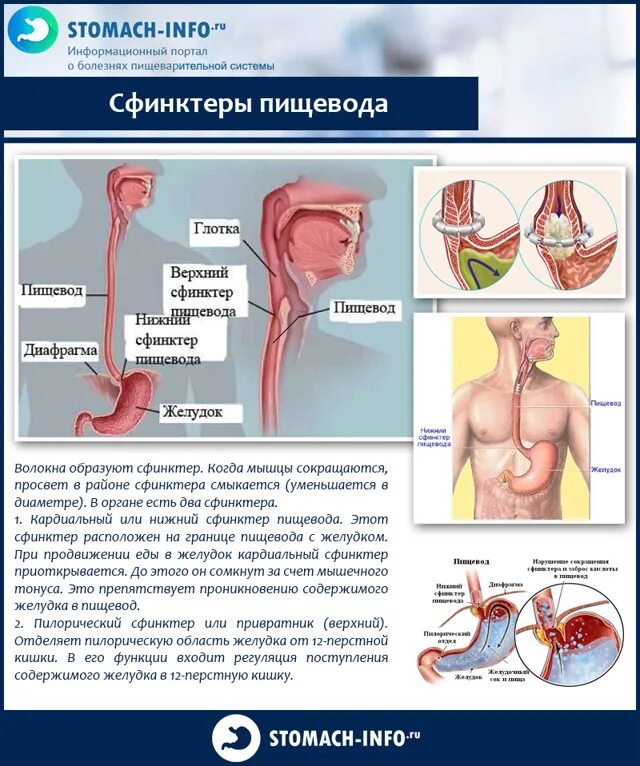 Изжога в пищеводе причины. Сфинктер желудка и пищевода. Пищеводно желудочный сфинктер.