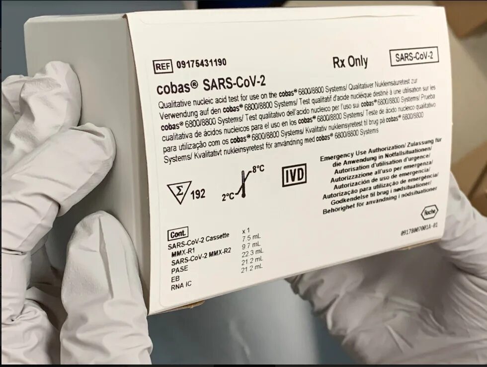 Ковид 11. Тест cov 2. Тест на Anti-SARS-cov-2 s. Тест на Сарс. SARS cov 2 результат теста.