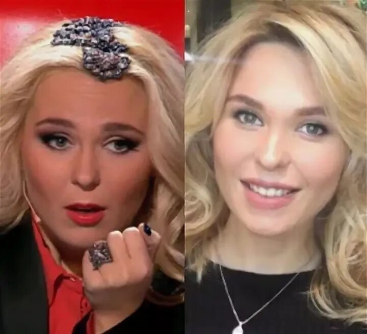 Пелагея сделала пластику до и после фото - ViktoriaFoto.ru