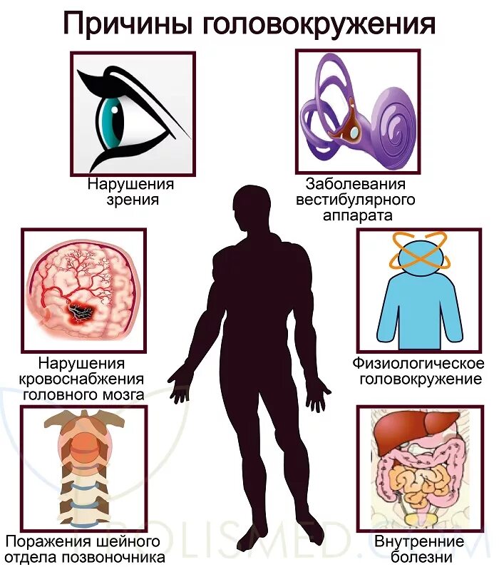 Почему бывает головокружение. Головокружение причины. Кружится голова причины. Кружение головы причины. Почему кружится голова почему кружится голова.