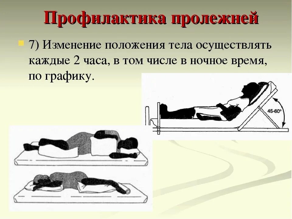 Пролежни как часто менять положение
