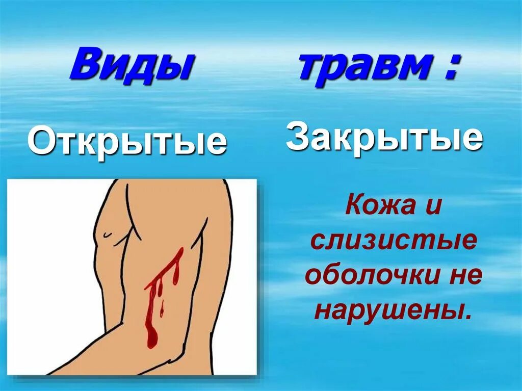 оказание первой помощи при травмах опорно-двигательного аппарата. изолированная травма. вид травмы 4. вид травмы 4. причины травм.
