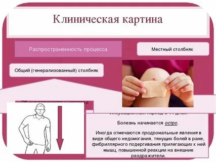 Что такое столбняк симптомы