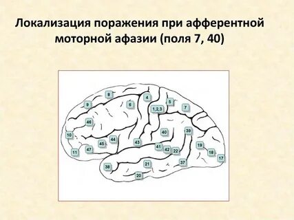 Моторная афазия поражение