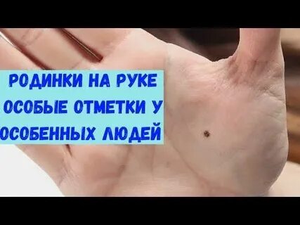 Родинки на холмах