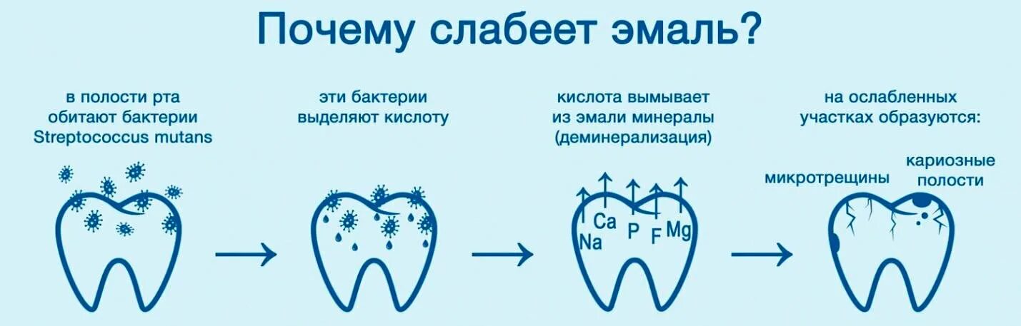 Реминерализация зубов схема. Причины кариеса зубов схема. Стадии кариеса молочных зубов схема. Резистентность эмали
