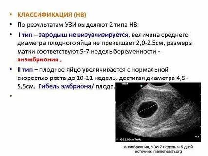 Плодное яйцо без эмбриона растет