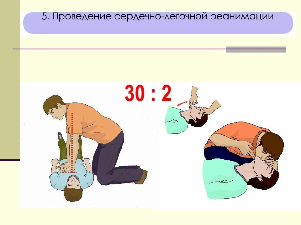 Оказание первой помощи при слр. Сердечно-легочная реанимация 2 вдоха 30 надавливаний. Алгоритм базовой сердечно-легочной реанимации в схеме. Сердечно-легочная реанимация алгоритм действий картинки. Алгоритм проведения базовой сердечно-легочной реанимации картинки.