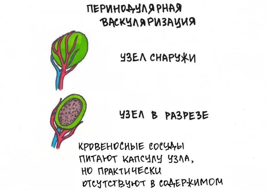 аваскулярный кровоток