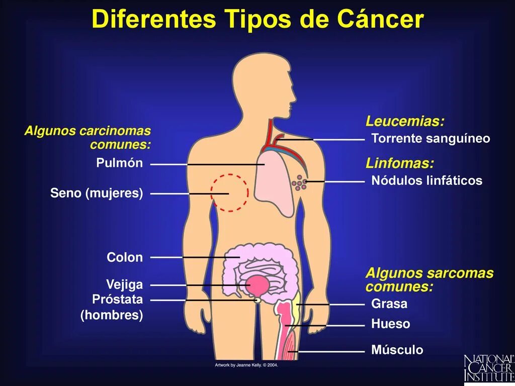 Почему бывает рак. Разновидности онкологии. Типы онкологических заболеваний. Разновидности раковых заболеваний. Раковые заболевания виды.