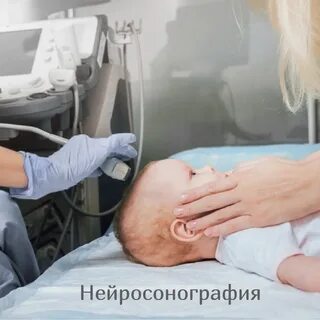 Узи головы самара