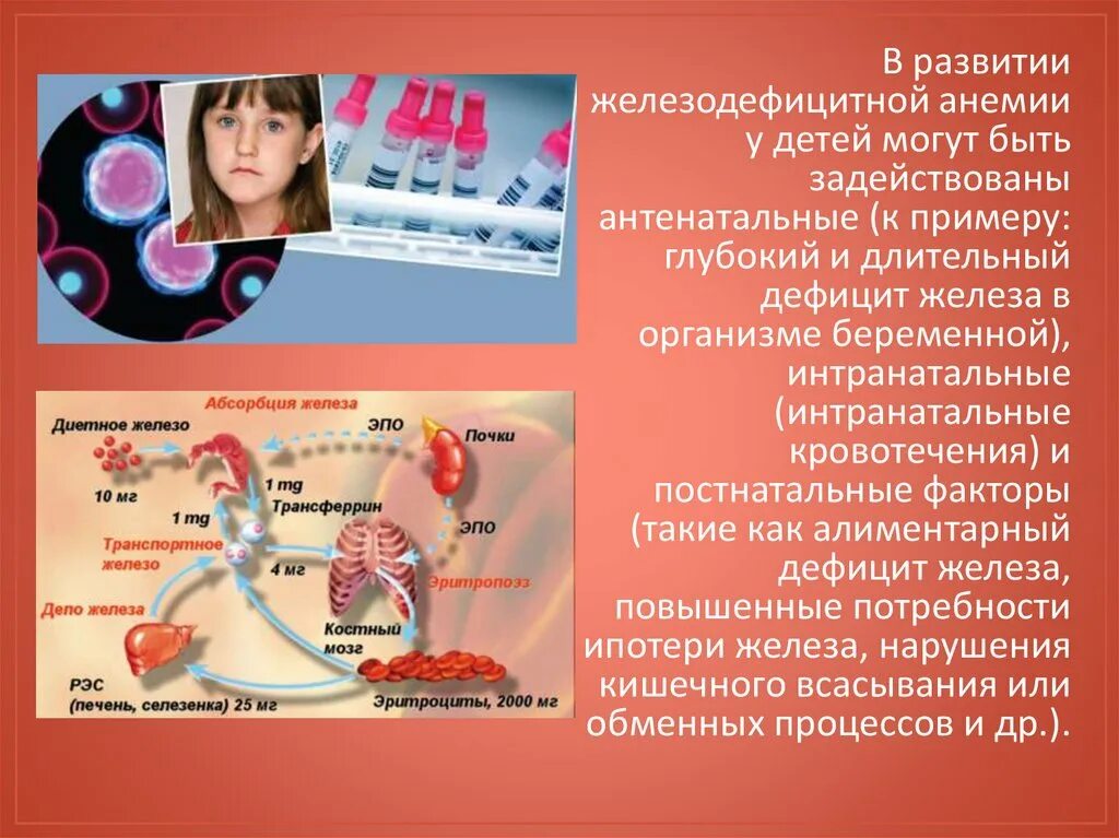 Аллергическая анемия. Факторы риска железодефицитной анемии. Факторы риска развития жда. Причины развития анемии. Факторы развития железодефицитной анемии.