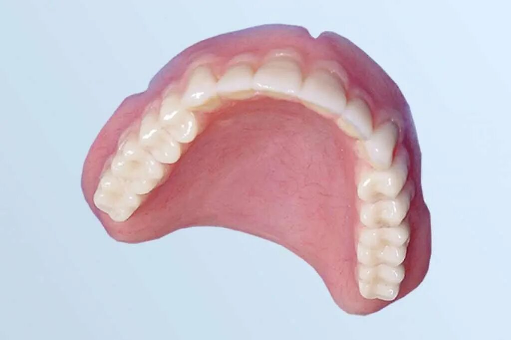 Протез на челюсть без зубов. Бюгельный протез на верхнюю челюсть. Съёмный бюгельный протез на верхнюю челюсть. Съемный протез (6-14 зубов) термо Джет. Экзостозы верхней челюсти.