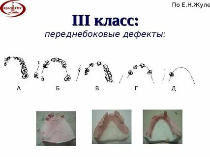 Классификация по гаврилову