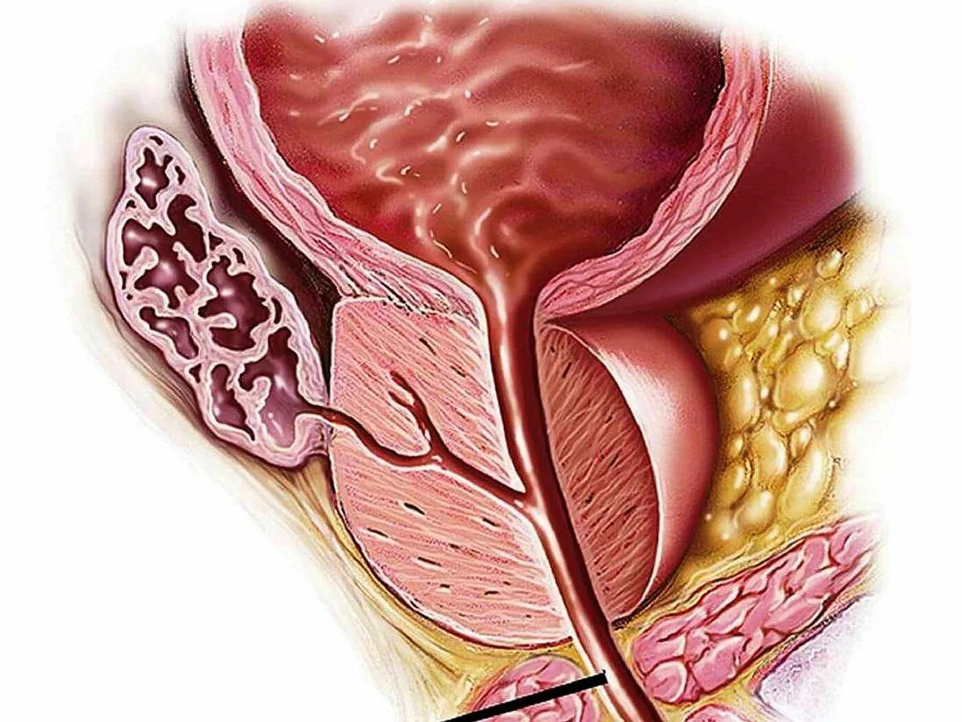 Предстательная железа, Prostata. Анатомия аденомы предстательной железы. Гиперплазия предстательной железы. Простата и предстательная железа. Простата это предстательная