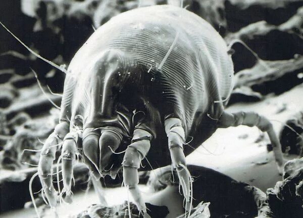 Клещи домашней пыли d farinae как выглядят How are dust mites harmful to humans