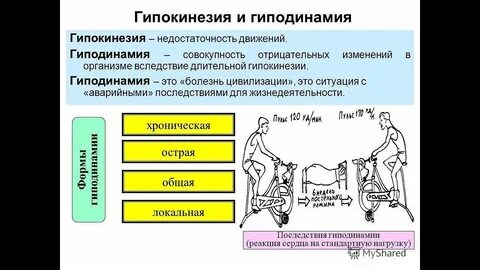 Гипокинезия