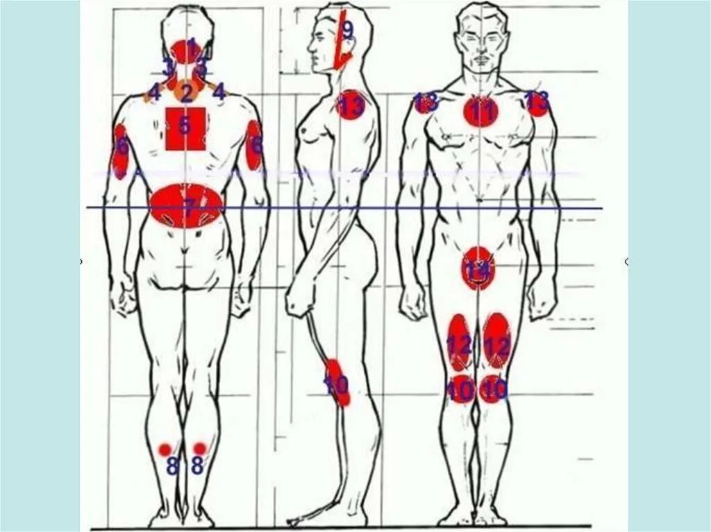 Точки болезненности. Точки на теле человека. Зоны тела. Участки тела человека. Болевые точки.