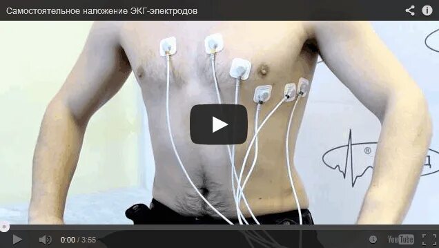 Как снять кардиограмму в домашних условиях #23 Теос: Продолжение Истории. Shaiya. Вечерний ламповый стрим. ФАРМИМ В СОЛО ОЗ