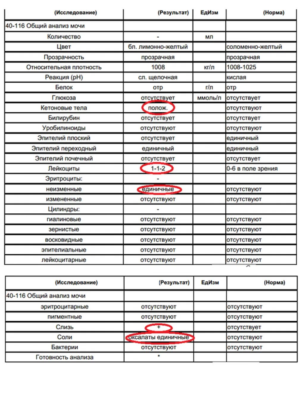 Анализ мочи норма соли оксалаты в моче. Анализ мочи расшифровка соли оксалаты норма. Анализ мочи соли оксалаты норма. Соли оксалата в норме. Слизь в моче у подростка