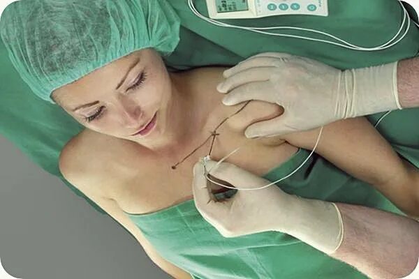 Операция под общим наркозом. Стоматология под общим наркозом. Зубная клиника под общим наркозом. Общая анестезия в стоматологии. Общий наркоз в стоматологии для детей.