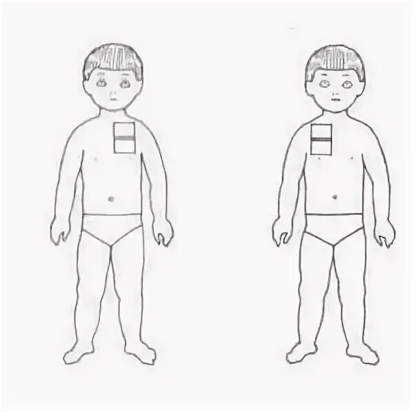 схема постановки горчичников при бронхите.