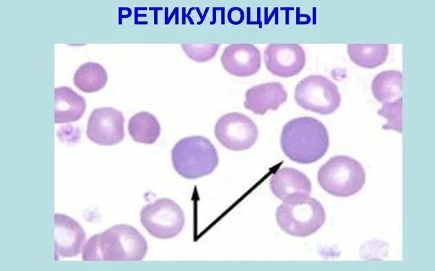 Определение ретикулоцитов