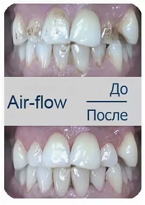 Airflow params