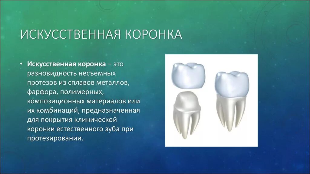 Противопоказания к изготовлению коронки. Искусственные коронки. Искусственные зубные коронки. Коронки ортопедическая стоматология. Одиночные искусственные коронки.