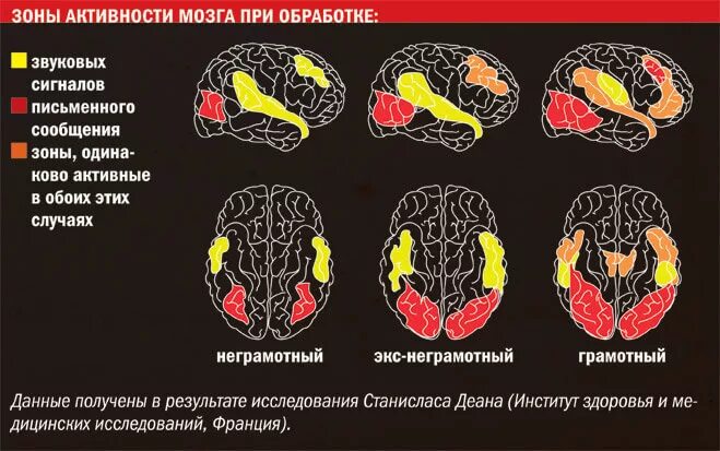 Активность мозга. Зоны активности мозга. Мозг во время чтения. Активность мозга при чтении.